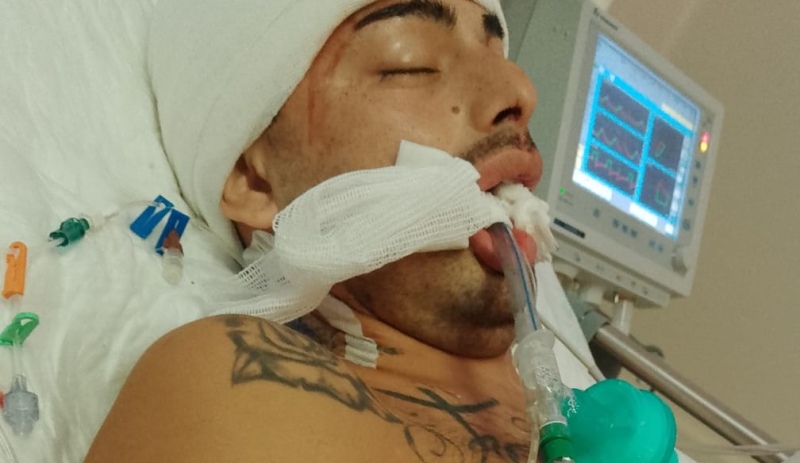 "Tenían planeado matarlo": el drama que vive el joven que fue atacado a fierrazos en Ezpeleta